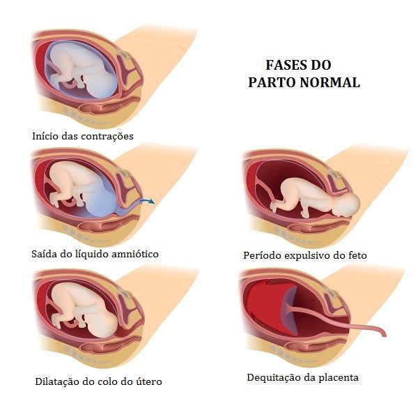 Parto Normal E Parto Cesárea Toda Matéria 