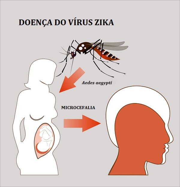 Zika Toda Matéria 5325