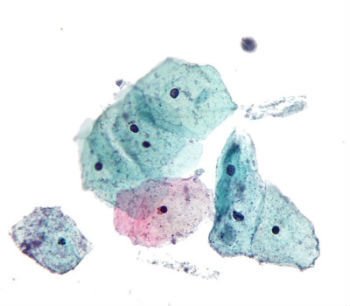 a-d. protoginia-a. tricomas rígidos no interior do tubo; b. ginostêmio