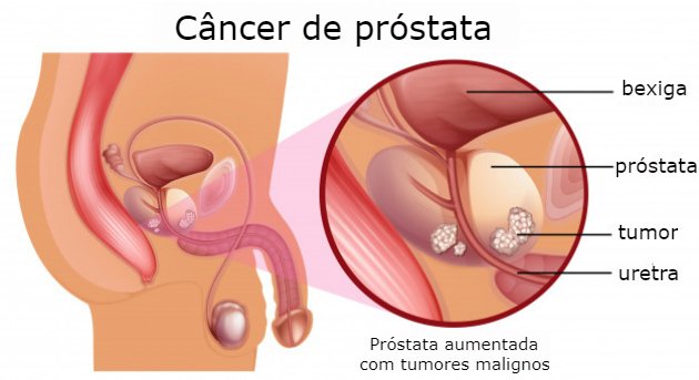 prostata anatomia e fisiologia