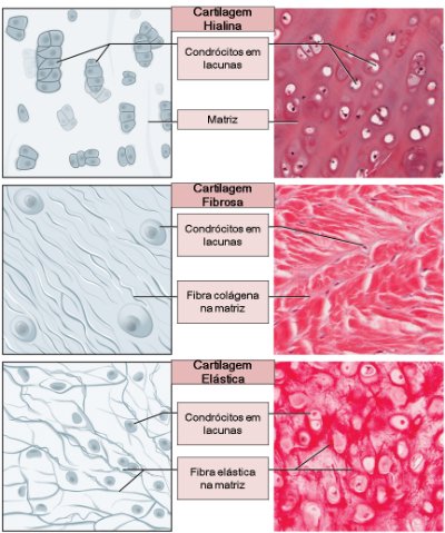 Tipos de Cartilagens