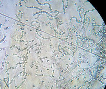 Cianobactérias observadas ao microscópio