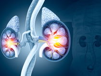 Exercícios sobre sistema urinário (com respostas explicadas)