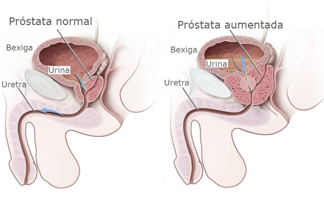 próstata anatomia e fisiologia)